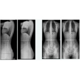 clínica para exame de tomografia escanometria digital Pimentas