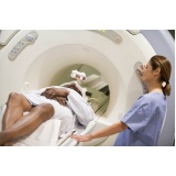 clínica para fazer tomografia do abdome superior preço Monte Carmelo