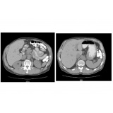 clínica para tomografia abdome total com contraste em Sp Sapopemba