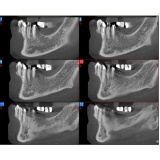 clínicas para exame de tomografia dental preço Belém