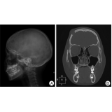 exame de imagem de ressonância magnética de crânio em sp Aricanduva