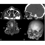 exame de imagem tomografia do crânio barato Cachoeirinha