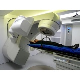 Laboratório de Radioterapia para Próstata