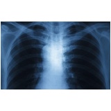 Clínica de Raio X em Sp