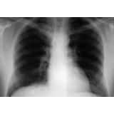 Laboratórios de Raio X