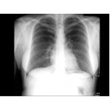 Exame de Radiografia a Preço Popular