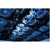 Exames de Tomografia Computadorizada