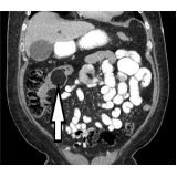 Exames de Tomografia