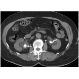 tomografia renal em sp Parque Peruche